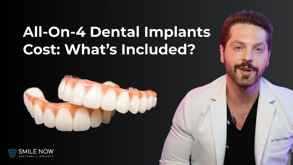 Thumbnail for a video discussing the all on 4 dental implants cost and what's included at Smile Now