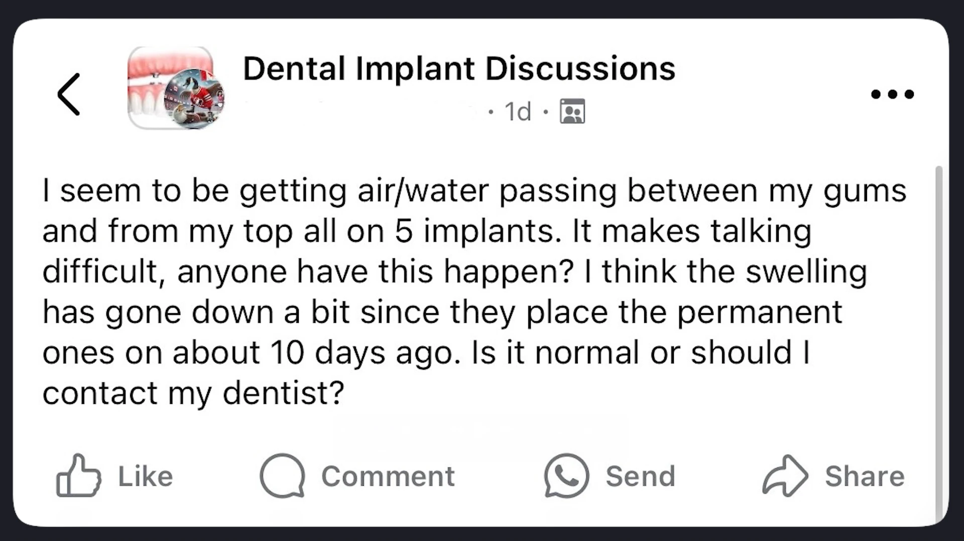 Patient question about dental implants problems: gaps and airflow between the bridge and gums.